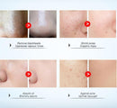 Roze Klei Masker
