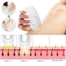 Belleza PRO - IPL Laser Hårfjerningsapparat